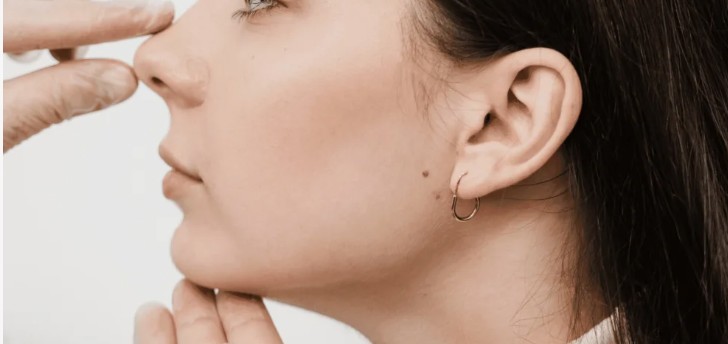 Rhinoplasty: What to Know Before Your First Consultation